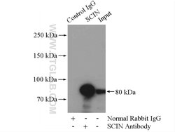 SCIN Rabbit anti-Human, Mouse, Rat, Polyclonal, Proteintech 150 &mu;L;
