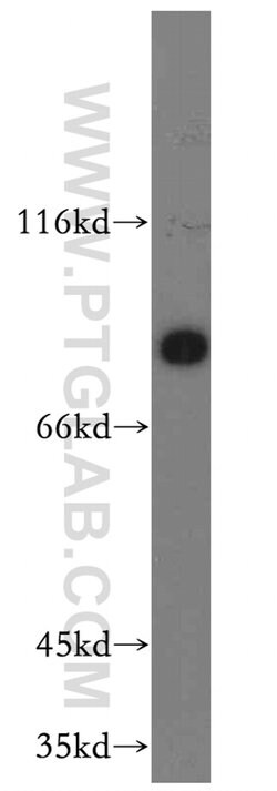 SCIN Rabbit anti-Human, Mouse, Rat, Polyclonal, Proteintech 150 &mu;L;
