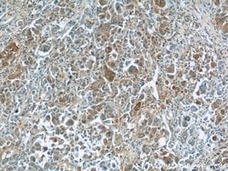 TNS4 Rabbit anti-Human, Mouse, Rat, Polyclonal, Proteintech 150 &mu;L;