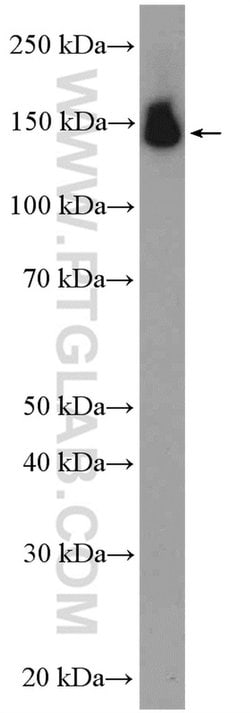 PUM2 Rabbit anti-Human, Mouse, Rat, Polyclonal, Proteintech