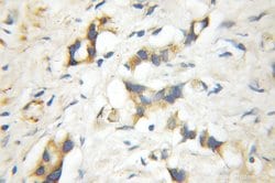 RGS5 Rabbit anti-Human, Mouse, Rat, Polyclonal, Proteintech:Antibodies:Primary