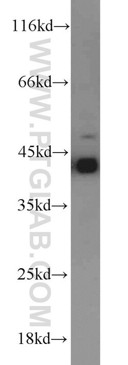 RGS5 Rabbit anti-Human, Mouse, Rat, Polyclonal, Proteintech:Antibodies:Primary
