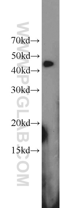 RGS5 Rabbit anti-Human, Mouse, Rat, Polyclonal, Proteintech:Antibodies:Primary