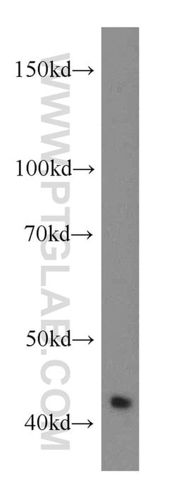 RGS5 Rabbit anti-Human, Mouse, Rat, Polyclonal, Proteintech:Antibodies:Primary
