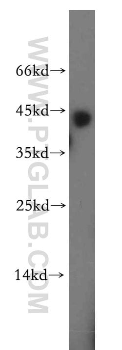 RGS5 Rabbit anti-Human, Mouse, Rat, Polyclonal, Proteintech:Antibodies:Primary