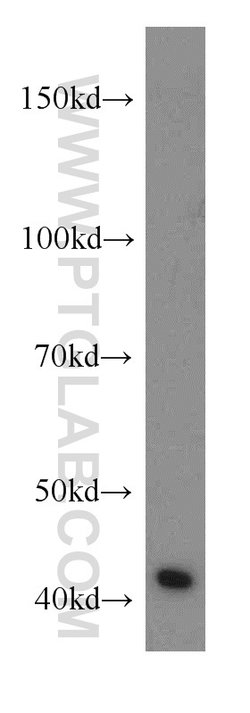 RGS5 Rabbit anti-Human, Mouse, Rat, Polyclonal, Proteintech:Antibodies:Primary