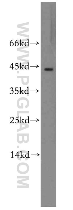RGS5 Rabbit anti-Human, Mouse, Rat, Polyclonal, Proteintech:Antibodies:Primary
