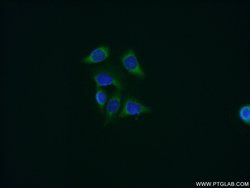 Cyclophilin B Rabbit anti-Human, Mouse, Polyclonal, Proteintech 150 &mu;L;