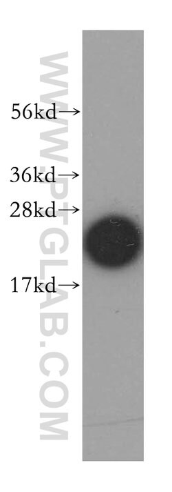 Cyclophilin B Rabbit anti-Human, Mouse, Polyclonal, Proteintech 150 &mu;L;