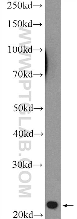 Cyclophilin B Rabbit anti-Human, Mouse, Polyclonal, Proteintech 150 &mu;L;