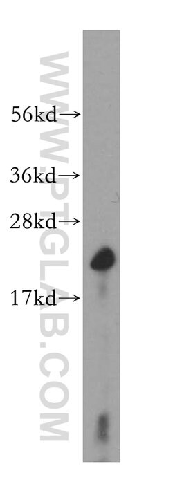 Cyclophilin B Rabbit anti-Human, Mouse, Polyclonal, Proteintech 150 &mu;L;