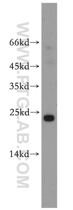 Cyclophilin B Rabbit anti-Human, Mouse, Polyclonal, Proteintech 150 &mu;L;