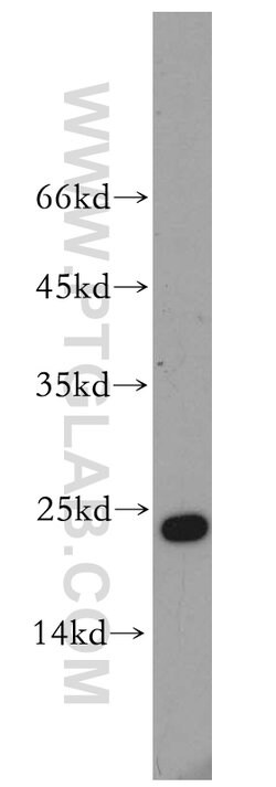 Cyclophilin B Rabbit anti-Human, Mouse, Polyclonal, Proteintech 150 &mu;L;