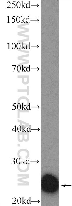 Cyclophilin B Rabbit anti-Human, Mouse, Polyclonal, Proteintech 150 &mu;L;