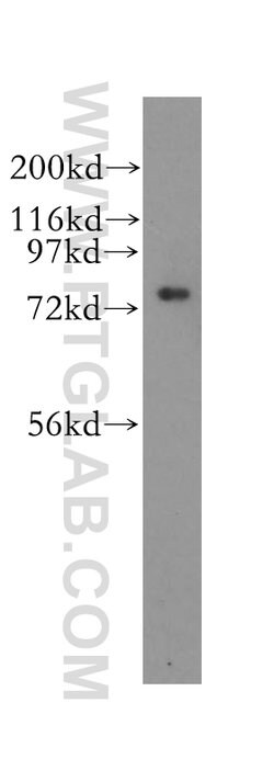 CPSF3 Rabbit anti-Human, Mouse, Rat, Polyclonal, Proteintech 150 &mu;L;