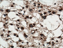 MTX2 Rabbit anti-Human, Mouse, Rat, Polyclonal, Proteintech:Antibodies:Primary