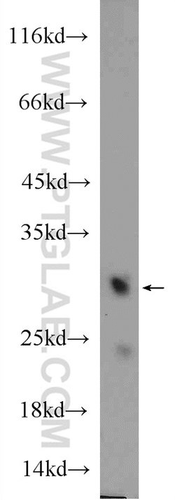 MTX2 Rabbit anti-Human, Mouse, Rat, Polyclonal, Proteintech:Antibodies:Primary