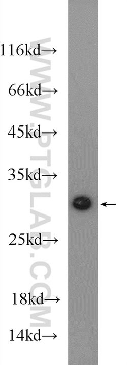 MTX2 Rabbit anti-Human, Mouse, Rat, Polyclonal, Proteintech:Antibodies:Primary