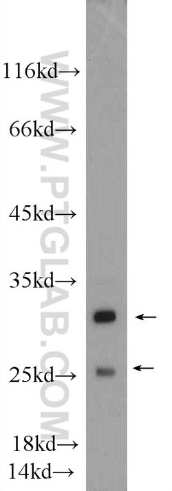 MTX2 Rabbit anti-Human, Mouse, Rat, Polyclonal, Proteintech:Antibodies:Primary