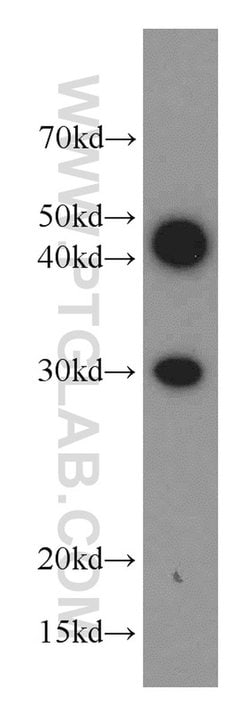 RAB20 Rabbit anti-Human, Mouse, Rat, Polyclonal, Proteintech 150 &mu;L;
