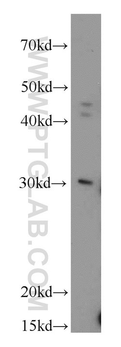 RAB20 Rabbit anti-Human, Mouse, Rat, Polyclonal, Proteintech 150 &mu;L;