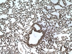 DOCK8 Rabbit anti-Human, Mouse, Rat, Polyclonal, Proteintech 150 &mu;L;
