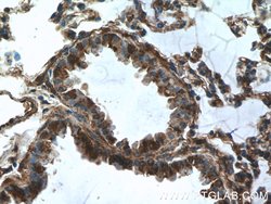 DOCK8 Rabbit anti-Human, Mouse, Rat, Polyclonal, Proteintech 150 &mu;L;
