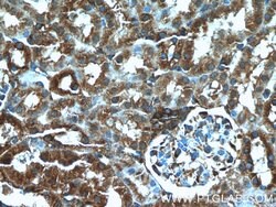 DOCK8 Rabbit anti-Human, Mouse, Rat, Polyclonal, Proteintech 150 &mu;L;