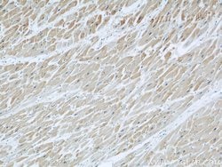 DOCK8 Rabbit anti-Human, Mouse, Rat, Polyclonal, Proteintech 150 &mu;L;