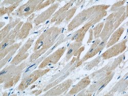 DOCK8 Rabbit anti-Human, Mouse, Rat, Polyclonal, Proteintech 150 &mu;L;