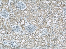 DOCK8 Rabbit anti-Human, Mouse, Rat, Polyclonal, Proteintech 150 &mu;L;