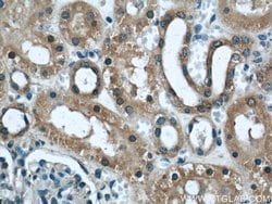 DOCK8 Rabbit anti-Human, Mouse, Rat, Polyclonal, Proteintech 150 &mu;L;