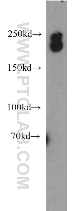 DOCK8 Rabbit anti-Human, Mouse, Rat, Polyclonal, Proteintech 150 &mu;L;