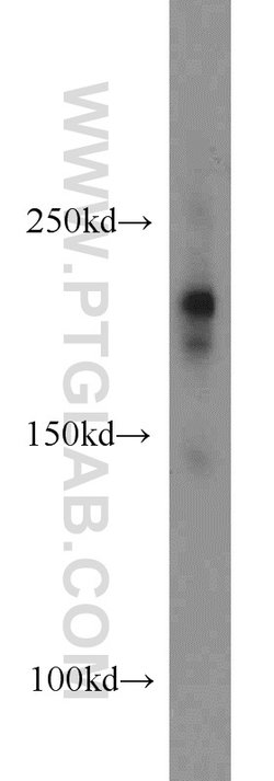 DOCK8 Rabbit anti-Human, Mouse, Rat, Polyclonal, Proteintech 150 &mu;L;