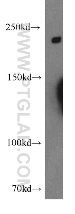 DOCK8 Rabbit anti-Human, Mouse, Rat, Polyclonal, Proteintech 150 &mu;L;