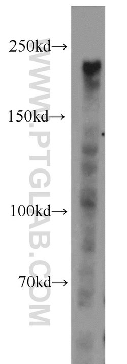 DOCK8 Rabbit anti-Human, Mouse, Rat, Polyclonal, Proteintech 150 &mu;L;