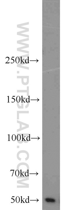 MIG6/ERRFI1 Rabbit anti-Human, Mouse, Rat, Polyclonal, Proteintech:Antibodies:Primary