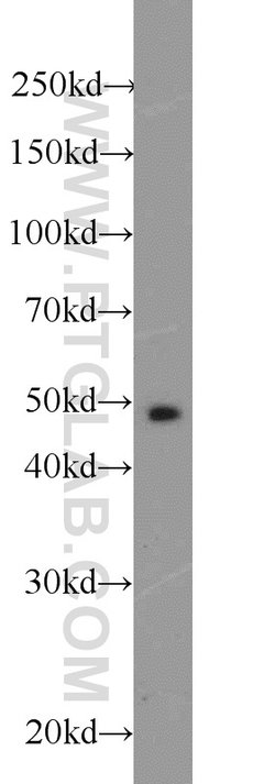 MIG6/ERRFI1 Rabbit anti-Human, Mouse, Rat, Polyclonal, Proteintech:Antibodies:Primary