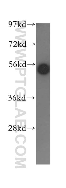 MIG6/ERRFI1 Rabbit anti-Human, Mouse, Rat, Polyclonal, Proteintech:Antibodies:Primary