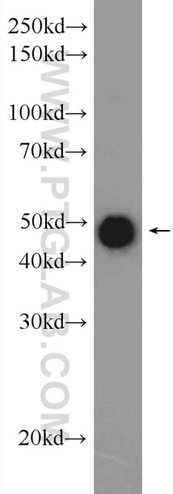 MIG6/ERRFI1 Rabbit anti-Human, Mouse, Rat, Polyclonal, Proteintech:Antibodies:Primary