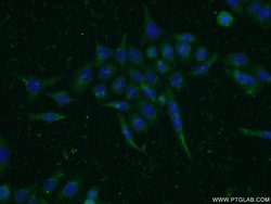 MIG6/ERRFI1 Rabbit anti-Human, Mouse, Rat, Polyclonal, Proteintech:Antibodies:Primary