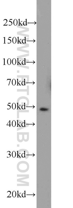 MIG6/ERRFI1 Rabbit anti-Human, Mouse, Rat, Polyclonal, Proteintech:Antibodies:Primary