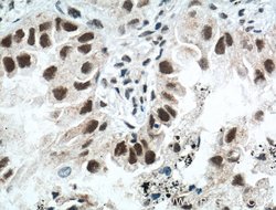 ZMYND8 Rabbit anti-Human, Mouse, Rat, Polyclonal, Proteintech:Antibodies:Primary