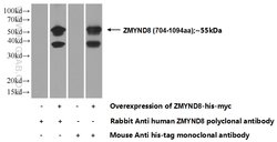 ZMYND8 Rabbit anti-Human, Mouse, Rat, Polyclonal, Proteintech:Antibodies:Primary