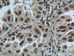 ZMYND8 Rabbit anti-Human, Mouse, Rat, Polyclonal, Proteintech:Antibodies:Primary