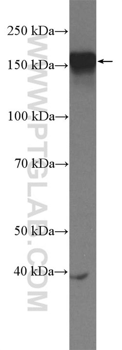 ZMYND8 Rabbit anti-Human, Mouse, Rat, Polyclonal, Proteintech:Antibodies:Primary
