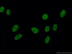 SAFB2 Rabbit anti-Human, Rat, Polyclonal, Proteintech:Antibodies:Primary
