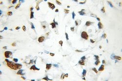 SAFB2 Rabbit anti-Human, Rat, Polyclonal, Proteintech:Antibodies:Primary