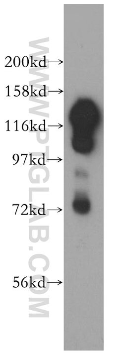 SAFB2 Rabbit anti-Human, Rat, Polyclonal, Proteintech:Antibodies:Primary