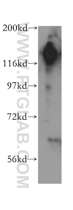 SAFB2 Rabbit anti-Human, Rat, Polyclonal, Proteintech:Antibodies:Primary